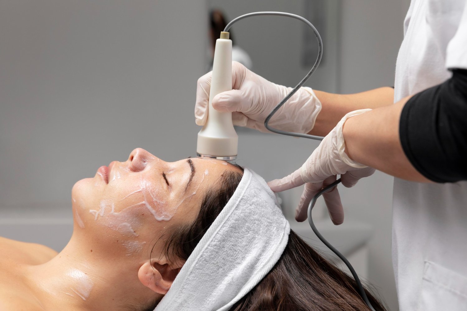 Derma, Mesotherapy , Stem Cells , Exosomes , Peeling