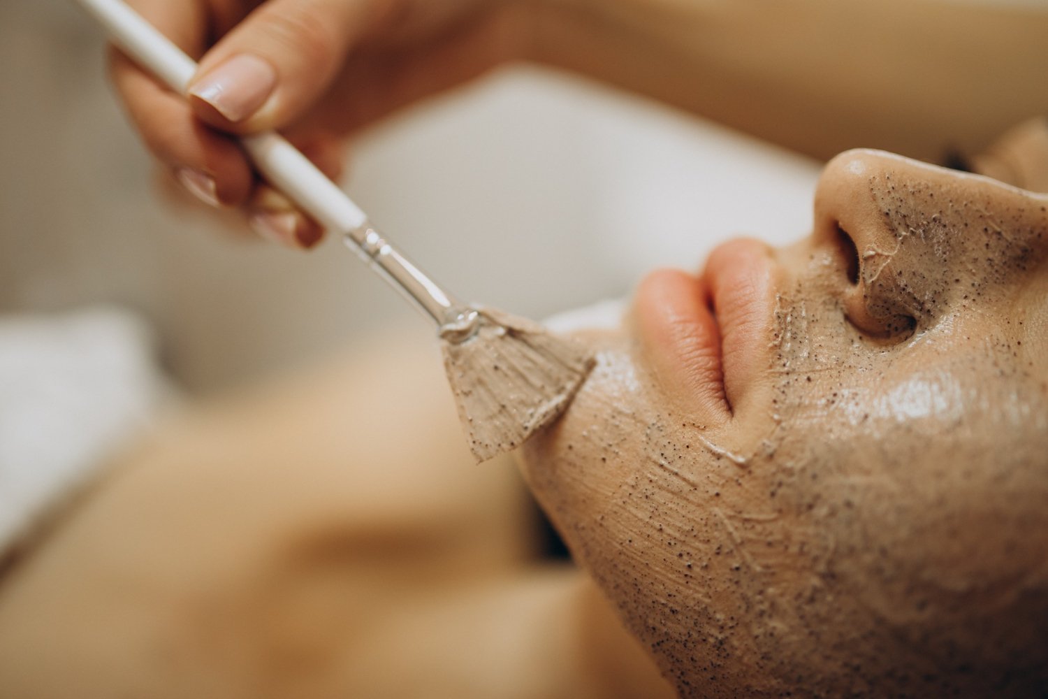 Peeling For acne, acne marks, and under-skin pimples