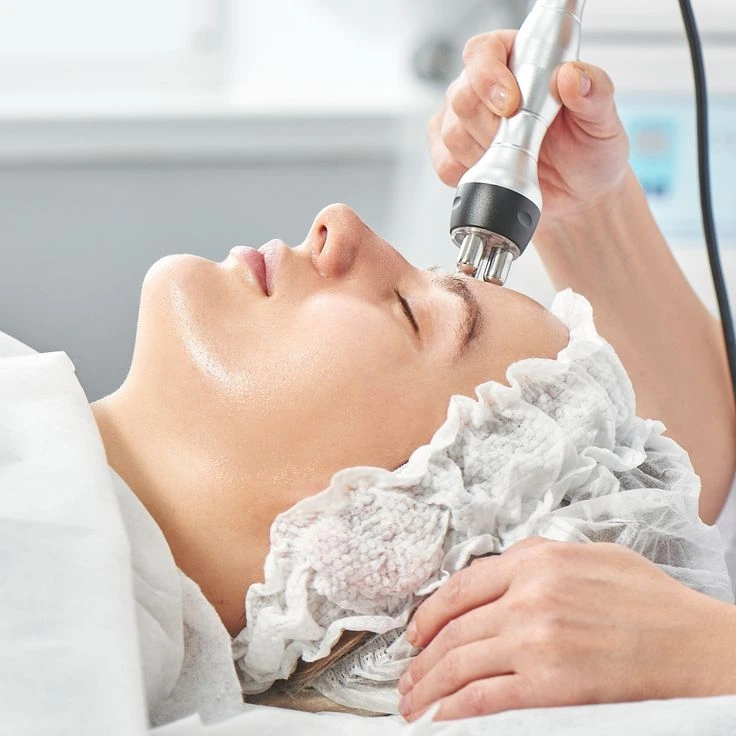 RF Face Lifting Session for face treatment
